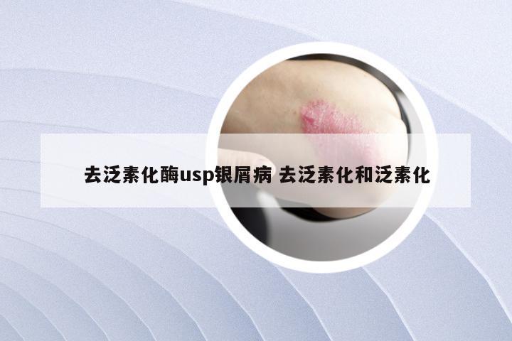 去泛素化酶usp银屑病 去泛素化和泛素化