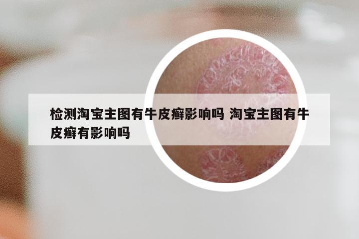 检测淘宝主图有牛皮癣影响吗 淘宝主图有牛皮癣有影响吗