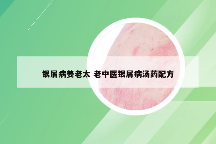 银屑病姜老太 老中医银屑病汤药配方