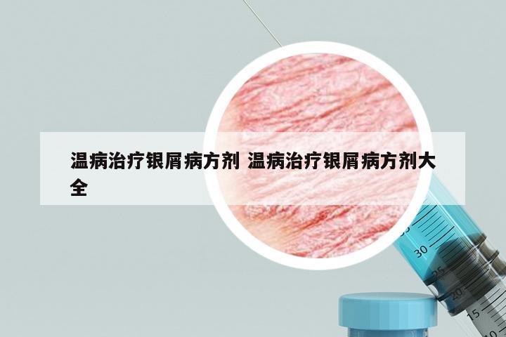 温病治疗银屑病方剂 温病治疗银屑病方剂大全