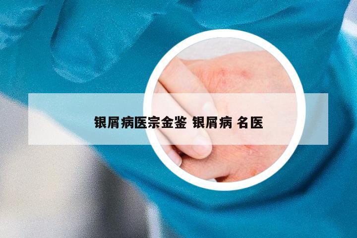 银屑病医宗金鉴 银屑病 名医