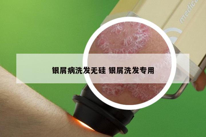 银屑病洗发无硅 银屑洗发专用