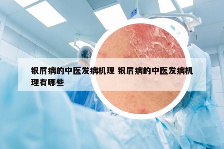 银屑病的中医发病机理 银屑病的中医发病机理有哪些