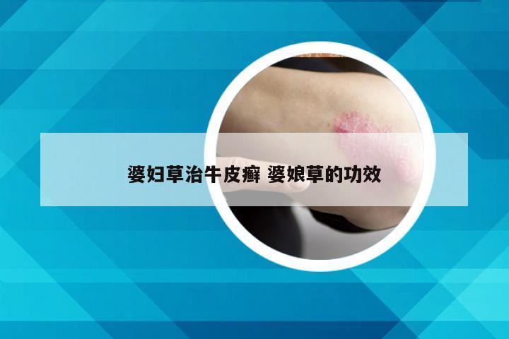 婆妇草治牛皮癣 婆娘草的功效