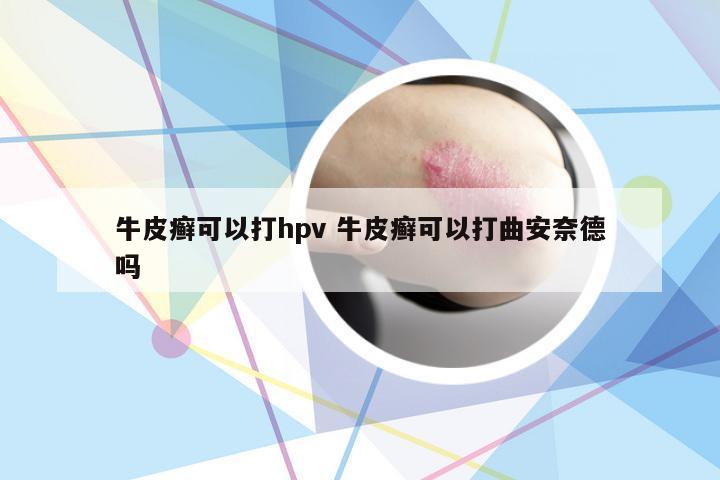 牛皮癣可以打hpv 牛皮癣可以打曲安奈德吗