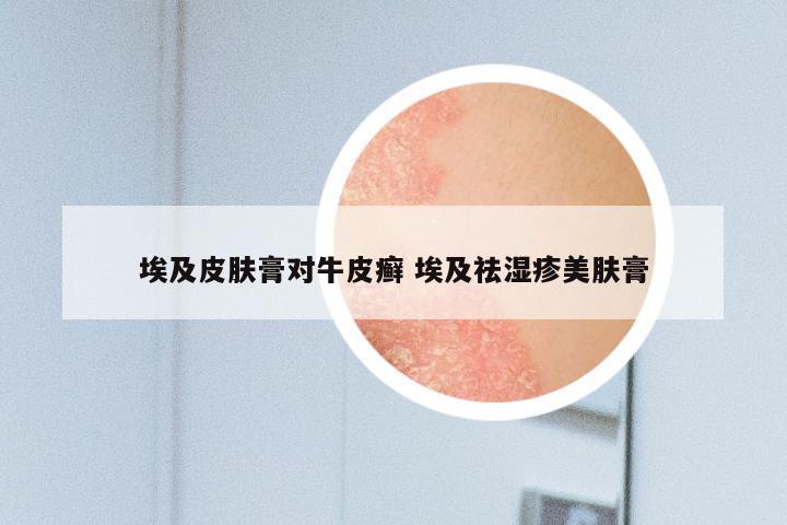 埃及皮肤膏对牛皮癣 埃及祛湿疹美肤膏