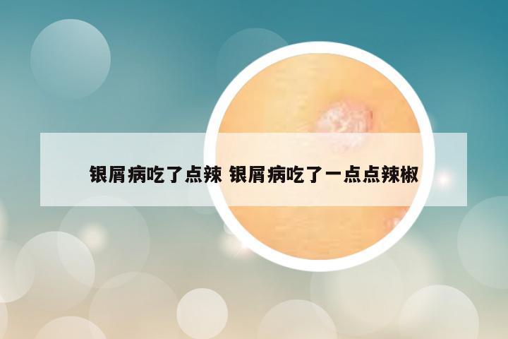 银屑病吃了点辣 银屑病吃了一点点辣椒
