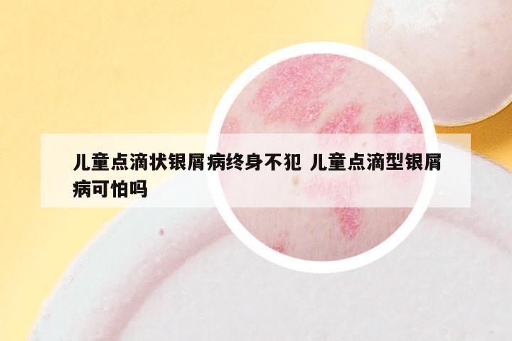 儿童点滴状银屑病终身不犯 儿童点滴型银屑病可怕吗