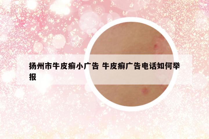 扬州市牛皮癣小广告 牛皮癣广告电话如何举报