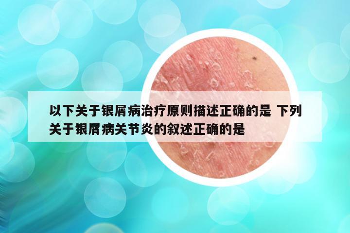 以下关于银屑病治疗原则描述正确的是 下列关于银屑病关节炎的叙述正确的是