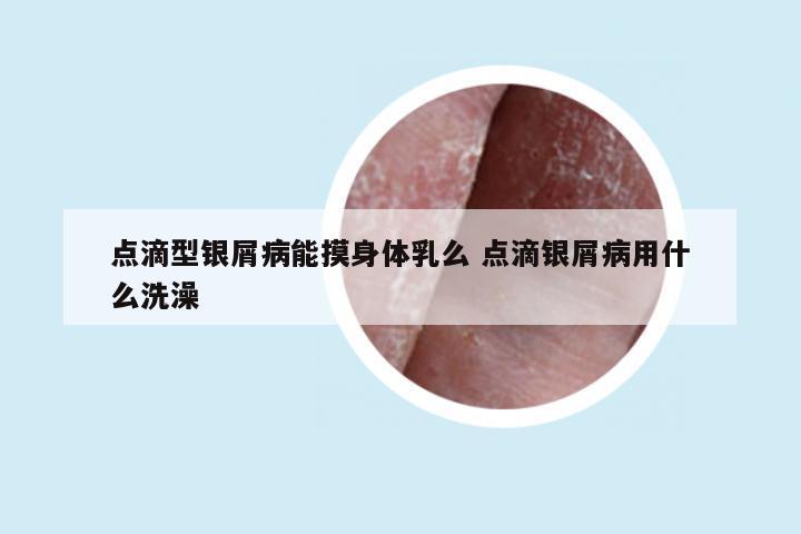 点滴型银屑病能摸身体乳么 点滴银屑病用什么洗澡