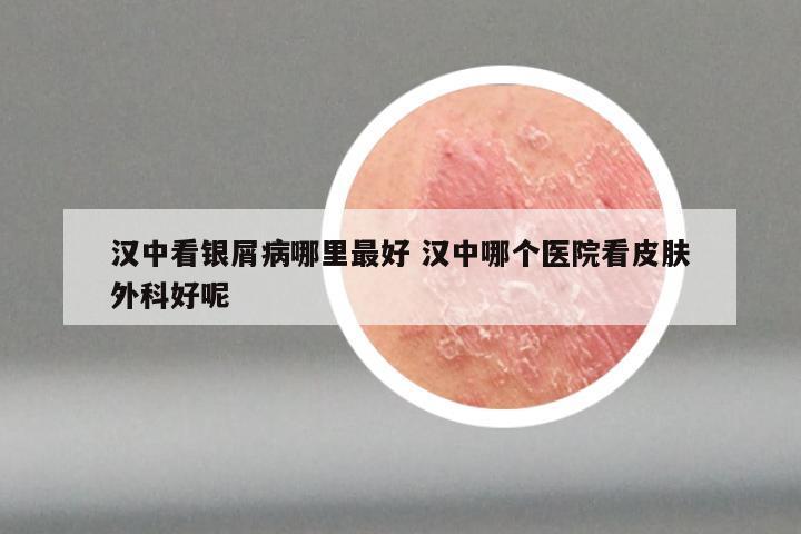 汉中看银屑病哪里最好 汉中哪个医院看皮肤外科好呢