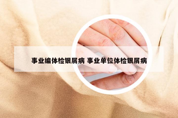 事业编体检银屑病 事业单位体检银屑病