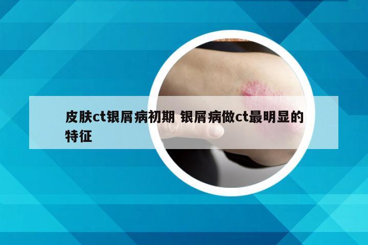 皮肤ct银屑病初期 银屑病做ct最明显的特征
