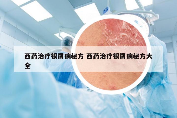 西药治疗银屑病秘方 西药治疗银屑病秘方大全
