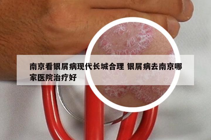 南京看银屑病现代长城合理 银屑病去南京哪家医院治疗好