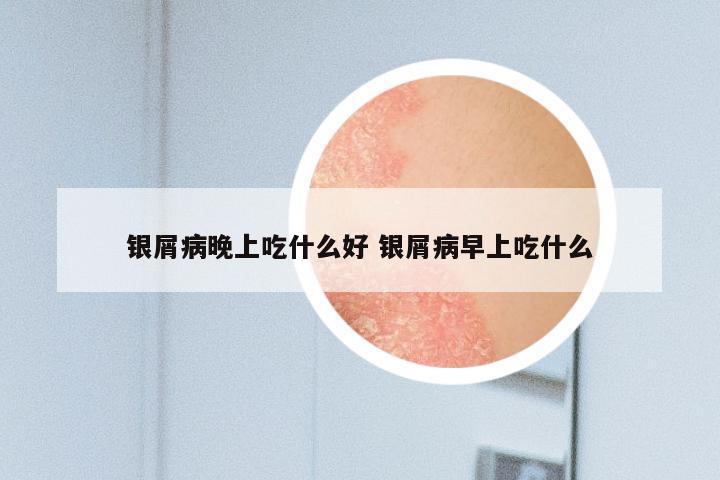 银屑病晚上吃什么好 银屑病早上吃什么