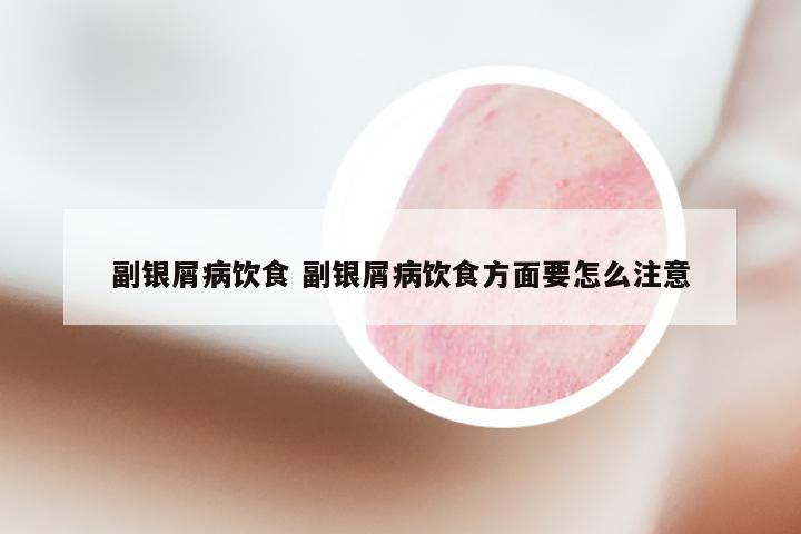 副银屑病饮食 副银屑病饮食方面要怎么注意