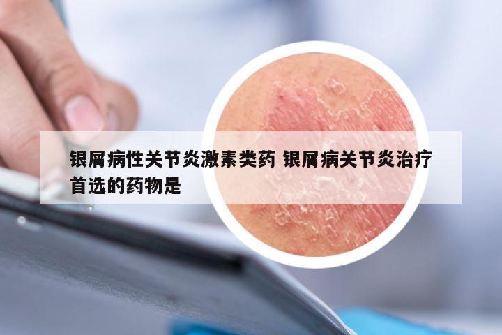 银屑病性关节炎激素类药 银屑病关节炎治疗首选的药物是