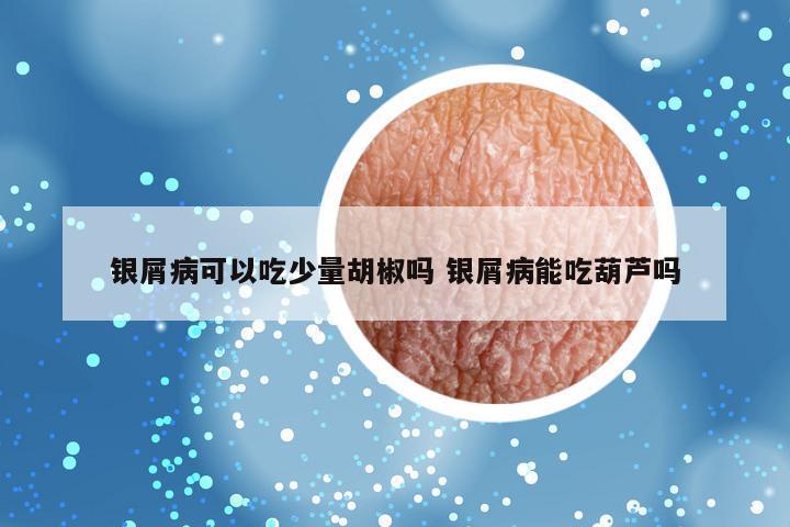 银屑病可以吃少量胡椒吗 银屑病能吃葫芦吗
