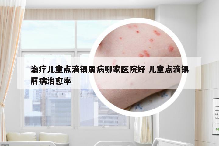 治疗儿童点滴银屑病哪家医院好 儿童点滴银屑病治愈率