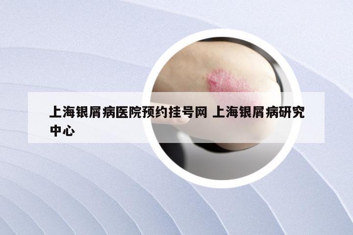上海银屑病医院预约挂号网 上海银屑病研究中心