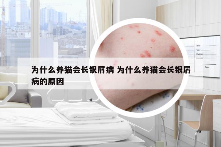 为什么养猫会长银屑病 为什么养猫会长银屑病的原因