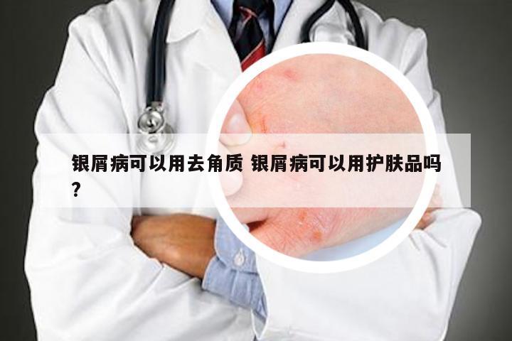 银屑病可以用去角质 银屑病可以用护肤品吗?