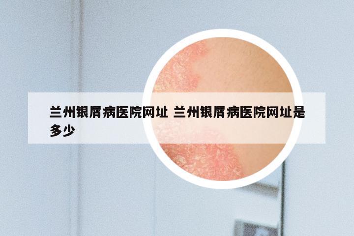 兰州银屑病医院网址 兰州银屑病医院网址是多少