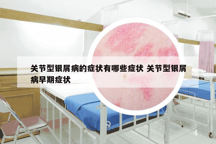 关节型银屑病的症状有哪些症状 关节型银屑病早期症状