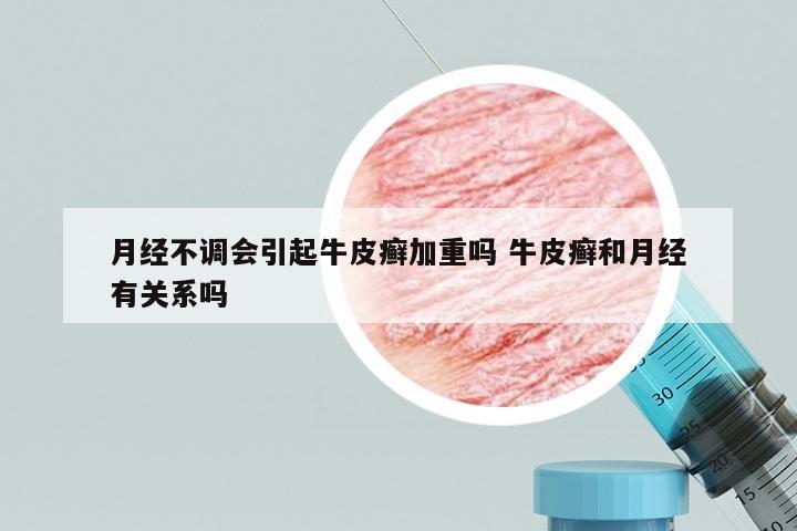 月经不调会引起牛皮癣加重吗 牛皮癣和月经有关系吗