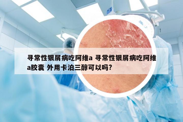 寻常性银屑病吃阿维a 寻常性银屑病吃阿维a胶囊 外用卡泊三醇可以吗?