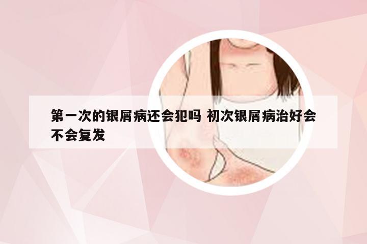 第一次的银屑病还会犯吗 初次银屑病治好会不会复发