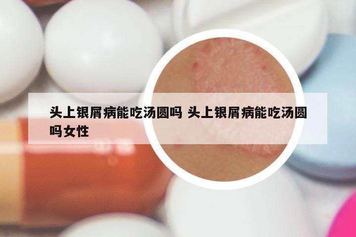 头上银屑病能吃汤圆吗 头上银屑病能吃汤圆吗女性