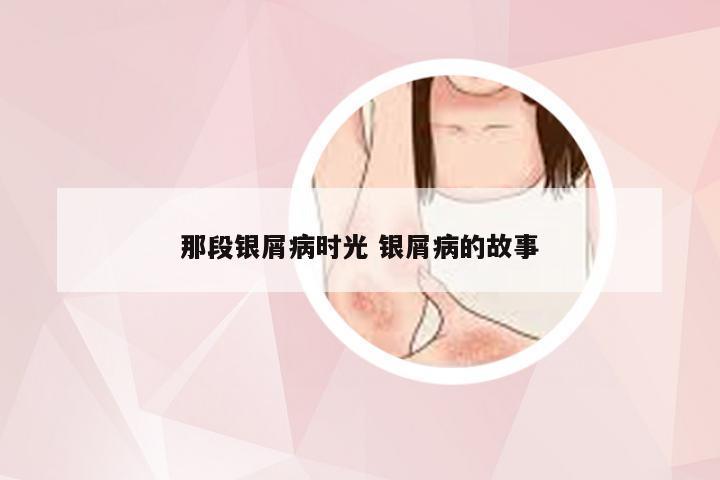 那段银屑病时光 银屑病的故事