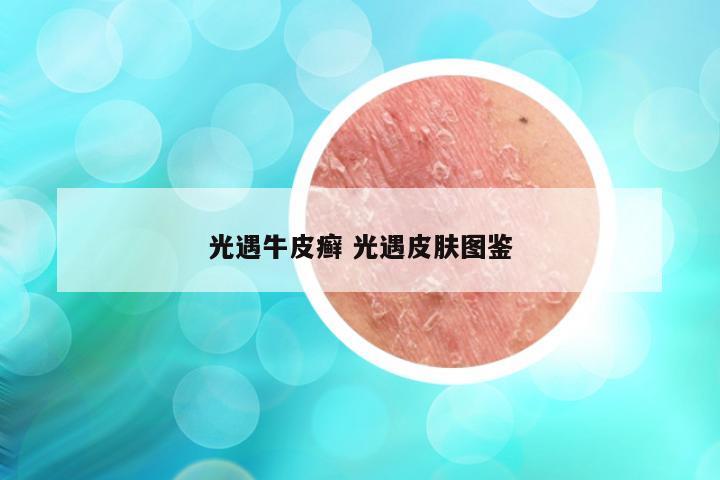 光遇牛皮癣 光遇皮肤图鉴