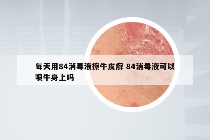 每天用84消毒液擦牛皮癣 84消毒液可以喷牛身上吗