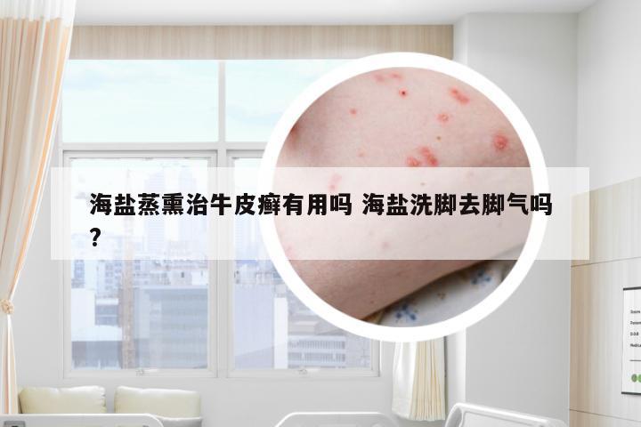 海盐蒸熏治牛皮癣有用吗 海盐洗脚去脚气吗?