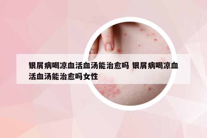 银屑病喝凉血活血汤能治愈吗 银屑病喝凉血活血汤能治愈吗女性