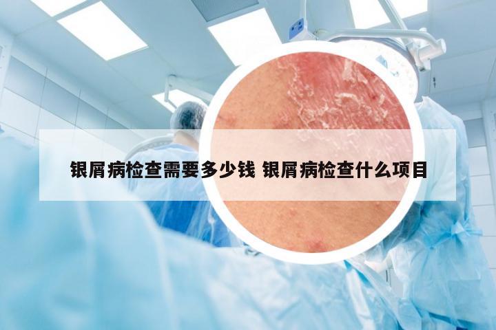 银屑病检查需要多少钱 银屑病检查什么项目