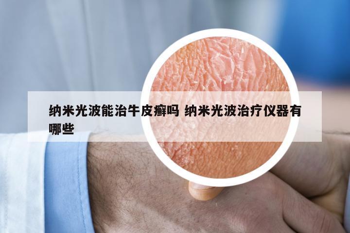 纳米光波能治牛皮癣吗 纳米光波治疗仪器有哪些