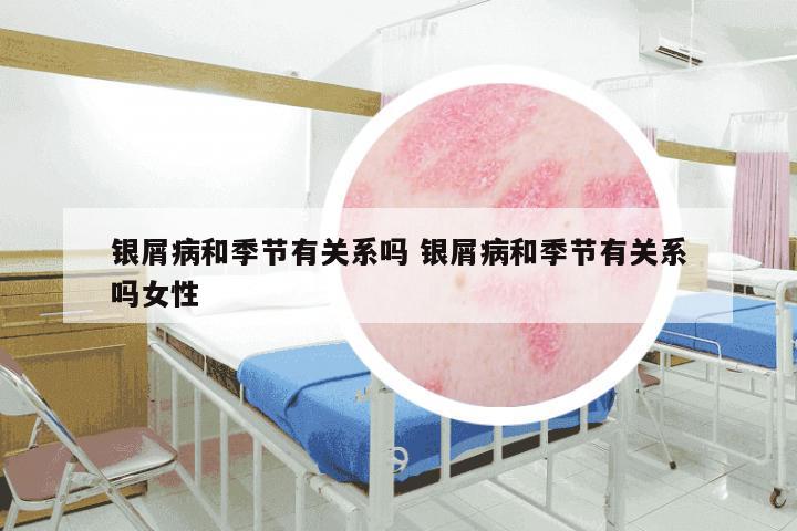银屑病和季节有关系吗 银屑病和季节有关系吗女性