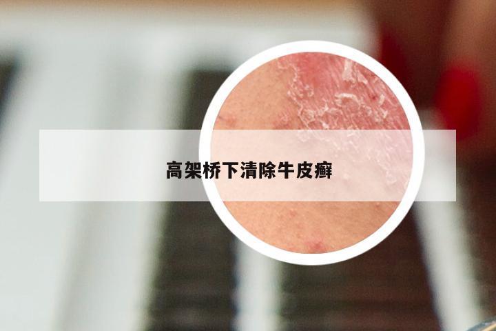 高架桥下清除牛皮癣