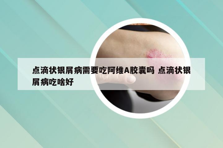 点滴状银屑病需要吃阿维A胶囊吗 点滴状银屑病吃啥好