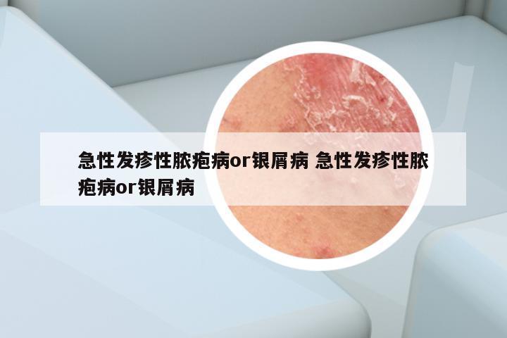 急性发疹性脓疱病or银屑病 急性发疹性脓疱病or银屑病