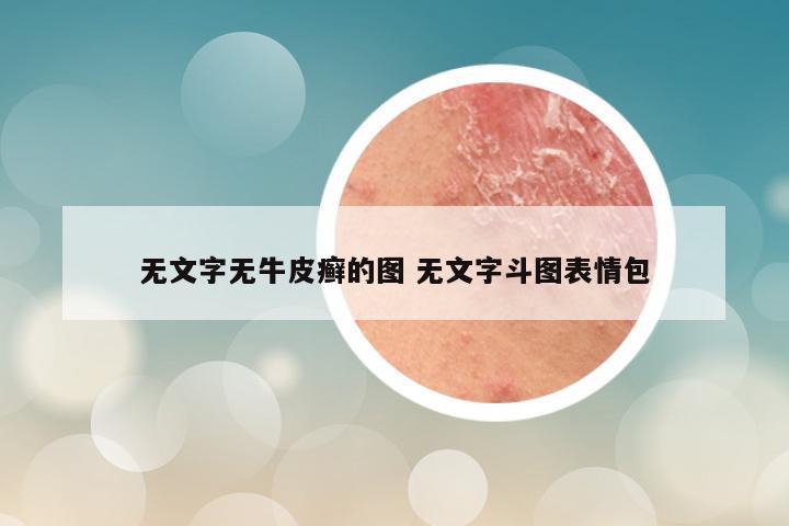 无文字无牛皮癣的图 无文字斗图表情包