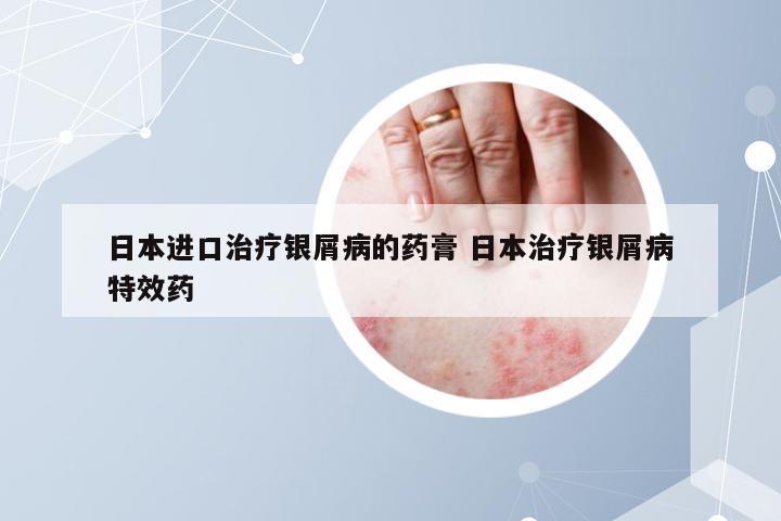 日本进口治疗银屑病的药膏 日本治疗银屑病特效药