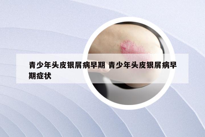 青少年头皮银屑病早期 青少年头皮银屑病早期症状
