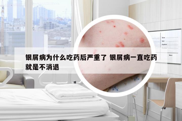 银屑病为什么吃药后严重了 银屑病一直吃药就是不消退
