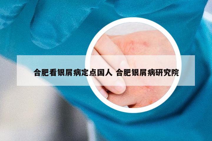 合肥看银屑病定点国人 合肥银屑病研究院